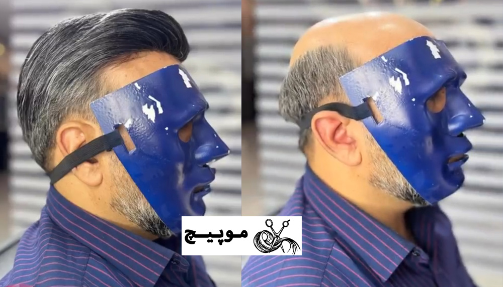 طبیعی ترین پوشش مو با موپیچ