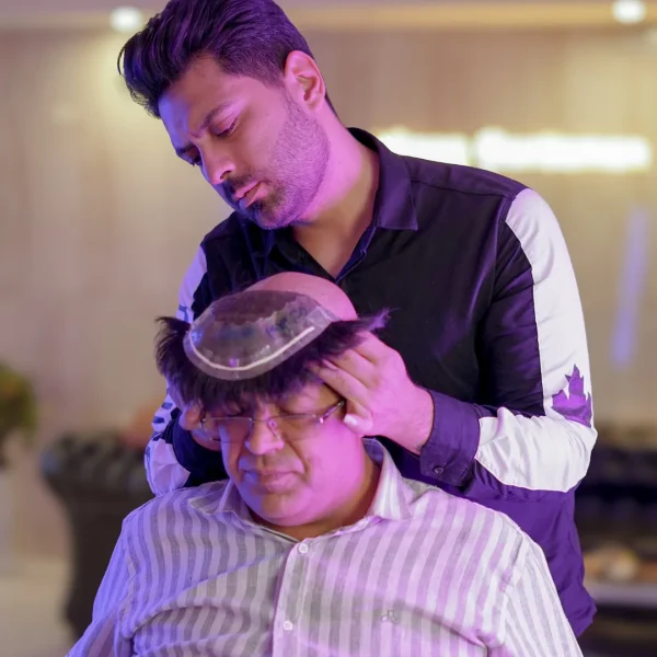 مرحله 2 | نصب پروتز مو